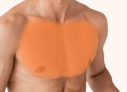 Mężczyzna z oznaczoną strefą depilacji klatki piersiowej