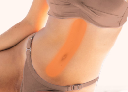 Kobieta z oznaczoną strefą depilacji linia brzucha